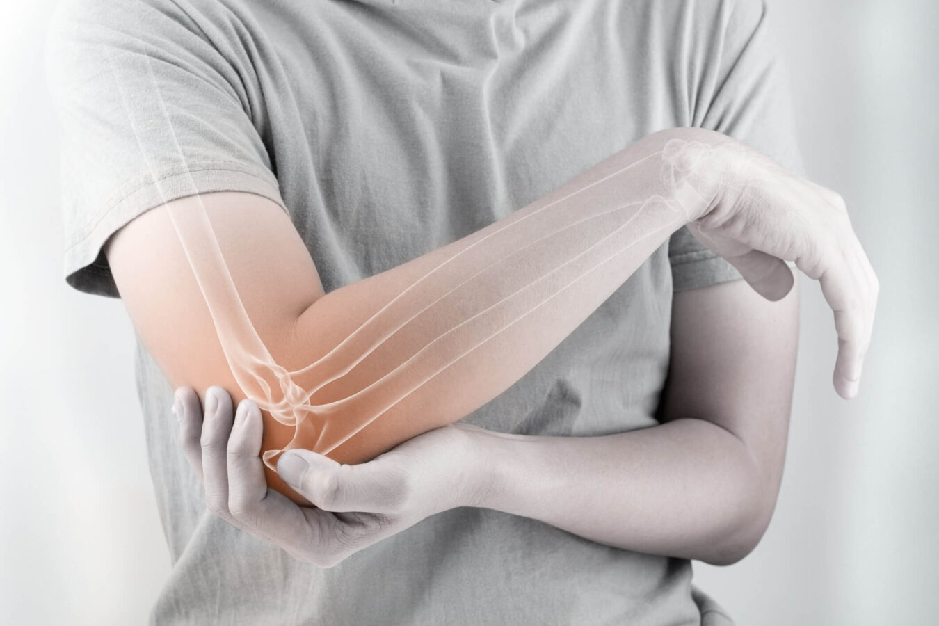 Elbow Fracture Treatment